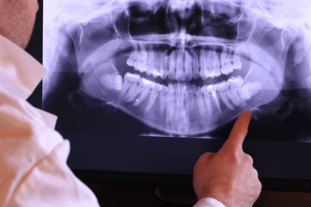 Tooth Infection Emergency Dentist in NC