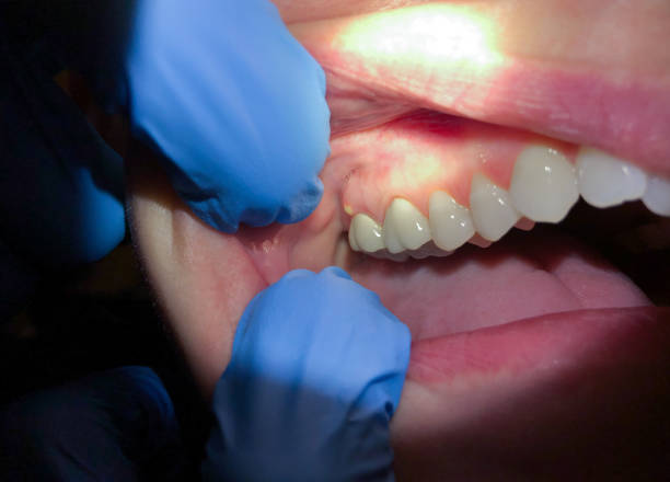 Best Teeth Whitening  in Barker Heights, NC