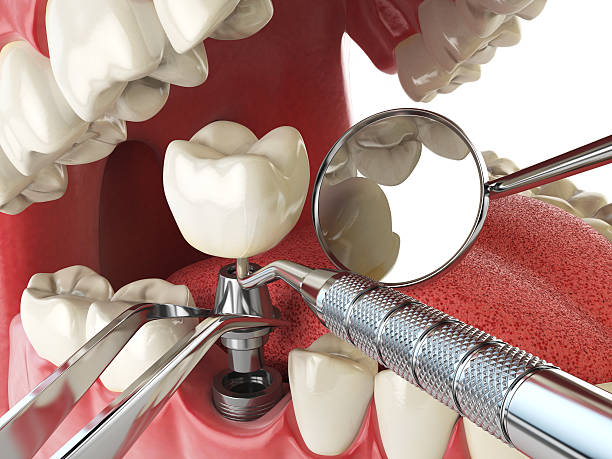 Best Emergency Dental Filling Replacement  in Barker Heights, NC
