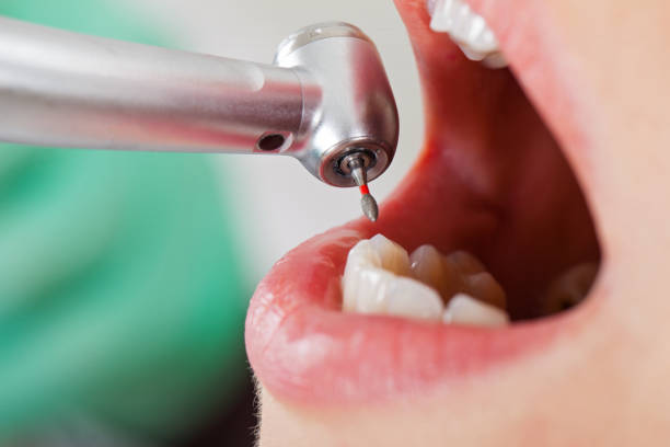 Best Emergency Gum Pain Relief  in Barker Heights, NC